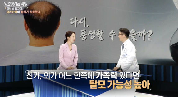 생로병사의비밀-탈모