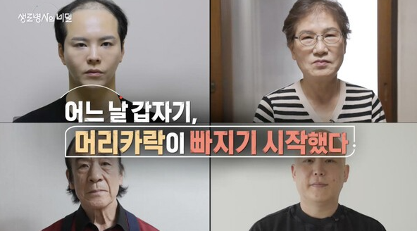 생로병사의비밀-탈모
